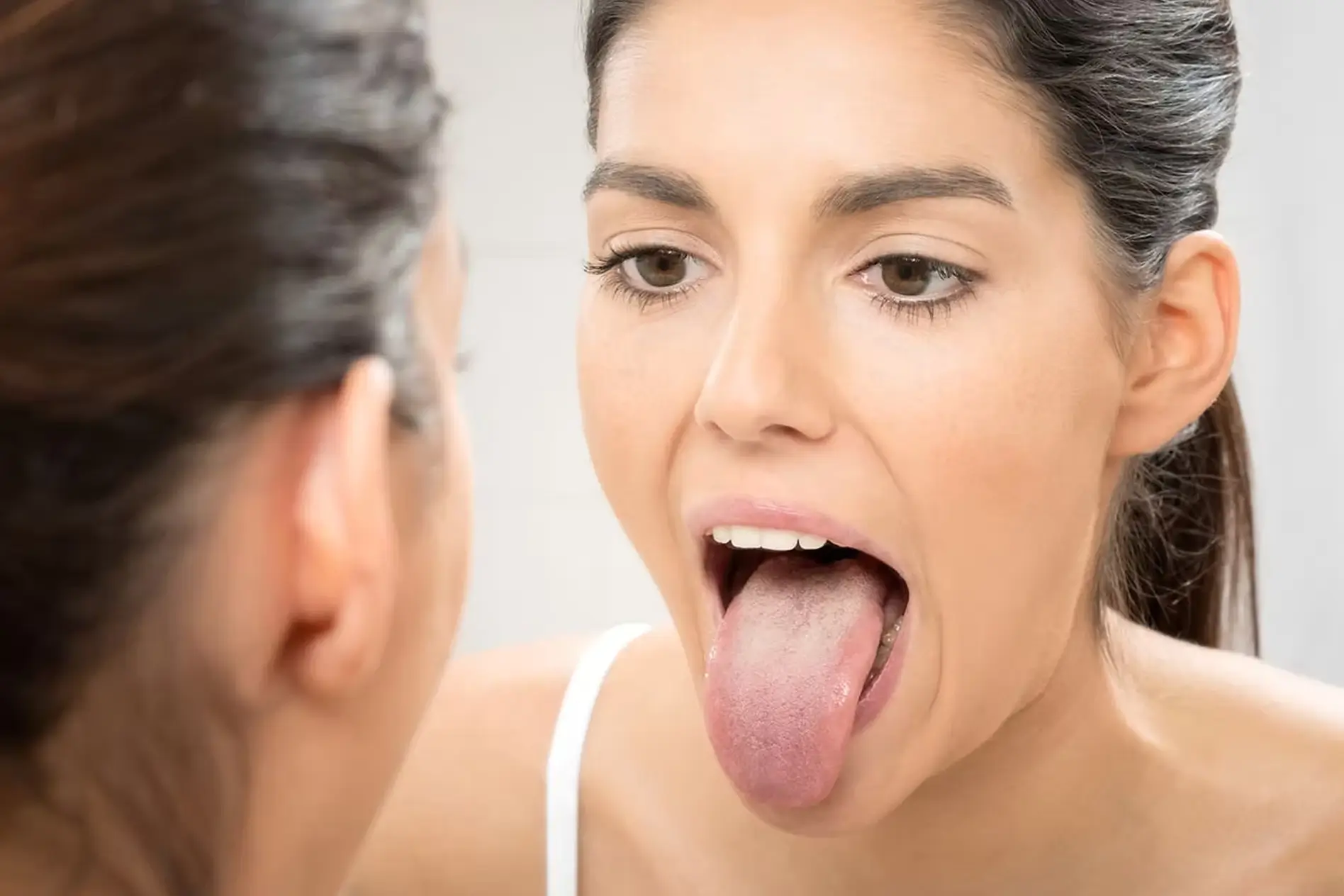 Saburra Lingual: O Que É, Por Que Causa Mau Hálito e Como Remover